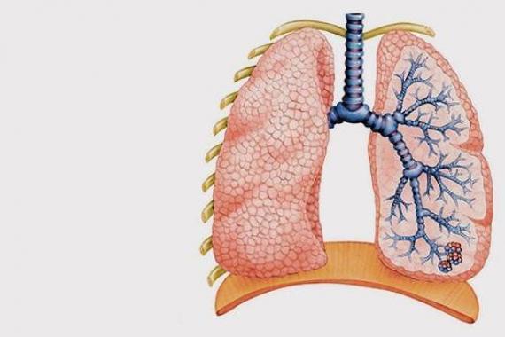 Хроническая обструктивная болезнь легких: симптомы, лечение хобл Хобл как определить степень тяжести дыхательной недостаточности
